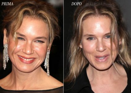 L'attrice Renee Zellweger